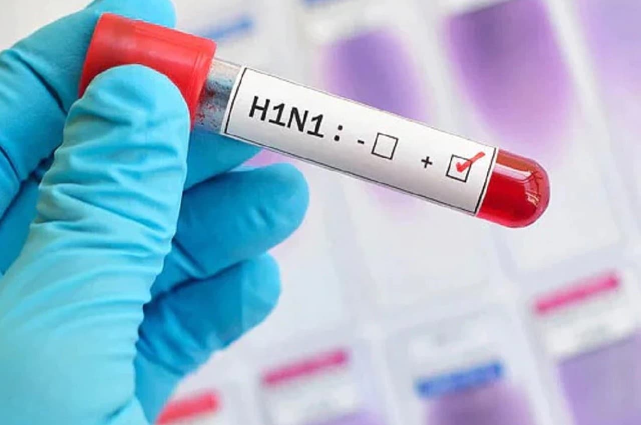 Swine Flu: झारखंड में स्वाइन फ्लू के चार केस मिले, हाई अलर्ट पर हेल्थ डिपार्टमेंट