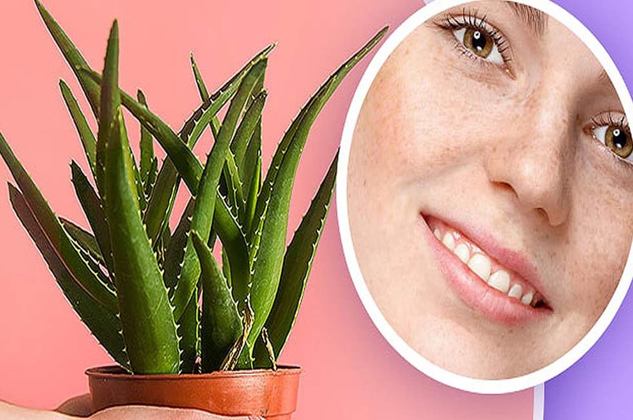 Skin Care TIPS: चेहरे की झाइयां हटा देगा एलोवेरा, बस हफ्ते में 3 बार ऐसे करें यूज