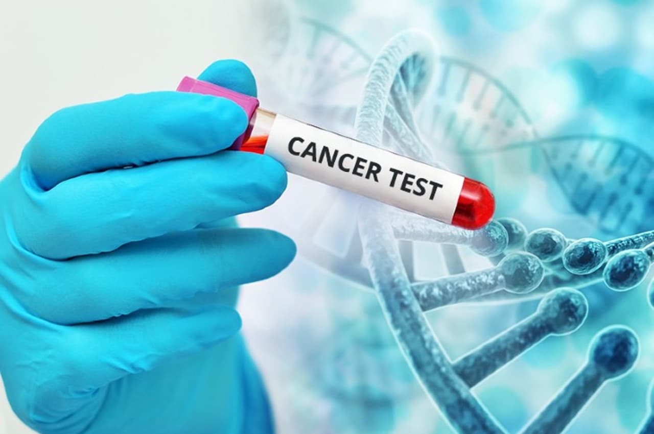Cancer Screening:  स्क्रीनिंग रोक सकती है कैंसर से होने वाली मौतें, एक्सपर्ट्स से जानें इसके बारे में सबकुछ