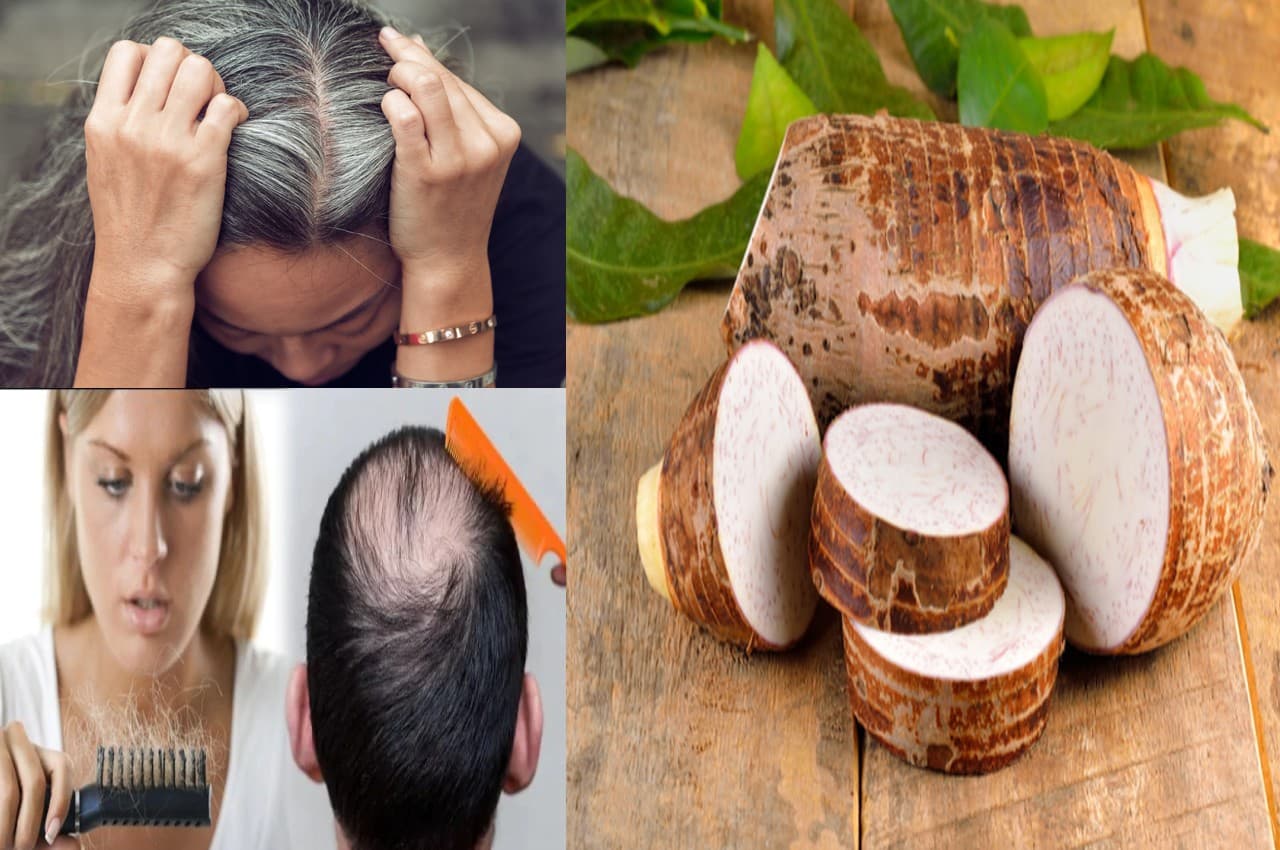 Hair Care Tips: हेयर में ऐसे लगाएं अरबी, सफेद बालों से मिलेगी निजात, ये 5 समस्याएं होंगी दूर