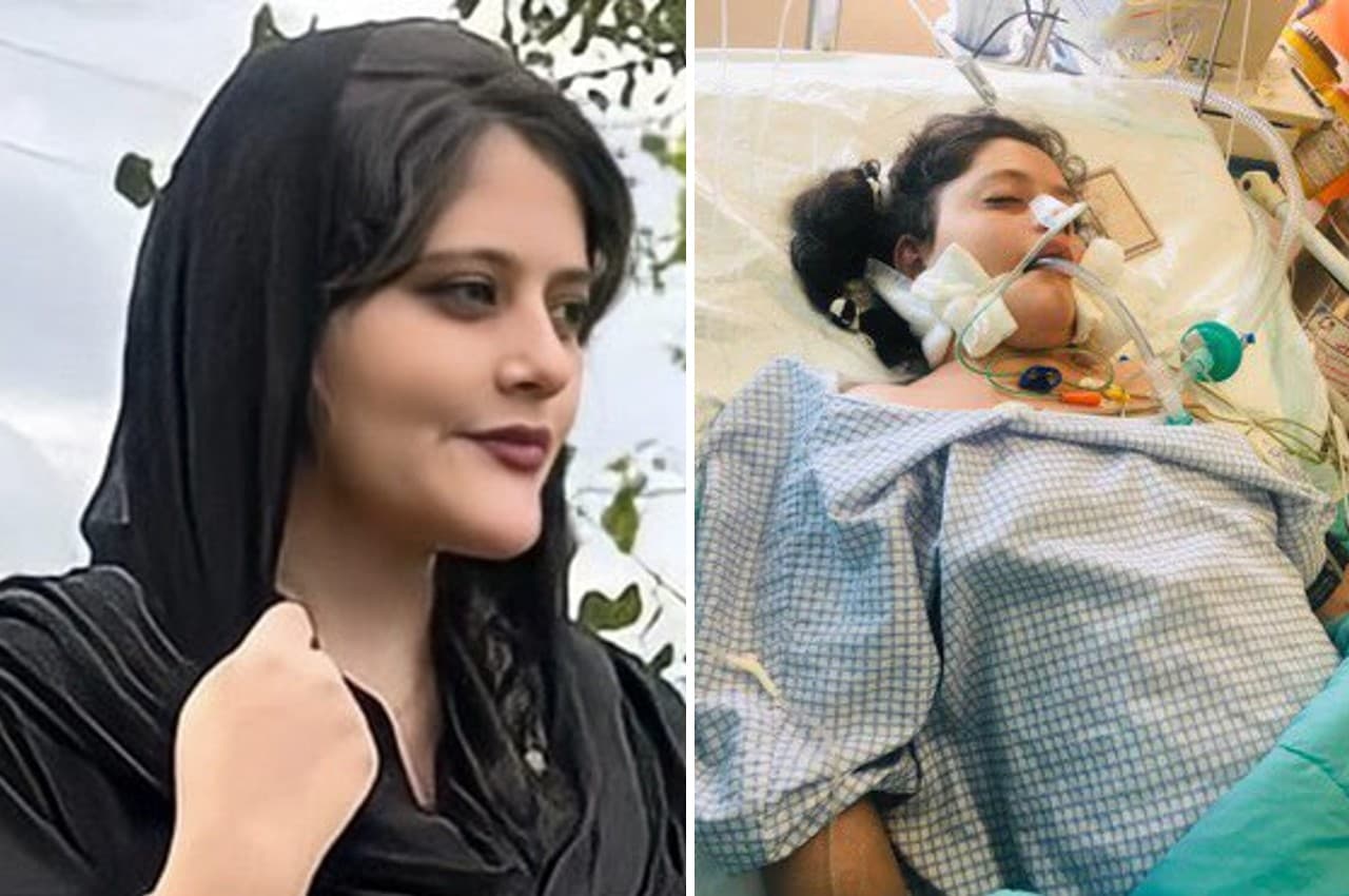 Iran: हिजाब न पहनने की इतनी खौफनाक सजा, पुलिस की पिटाई से कोमा में गई 22 साल की अमिनी की मौत