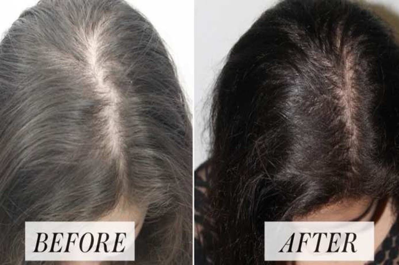 Hair care TIPS: इस घरेलू नुस्खे से बालों का झड़ना होगा बंद, मजबूती भी आएगी