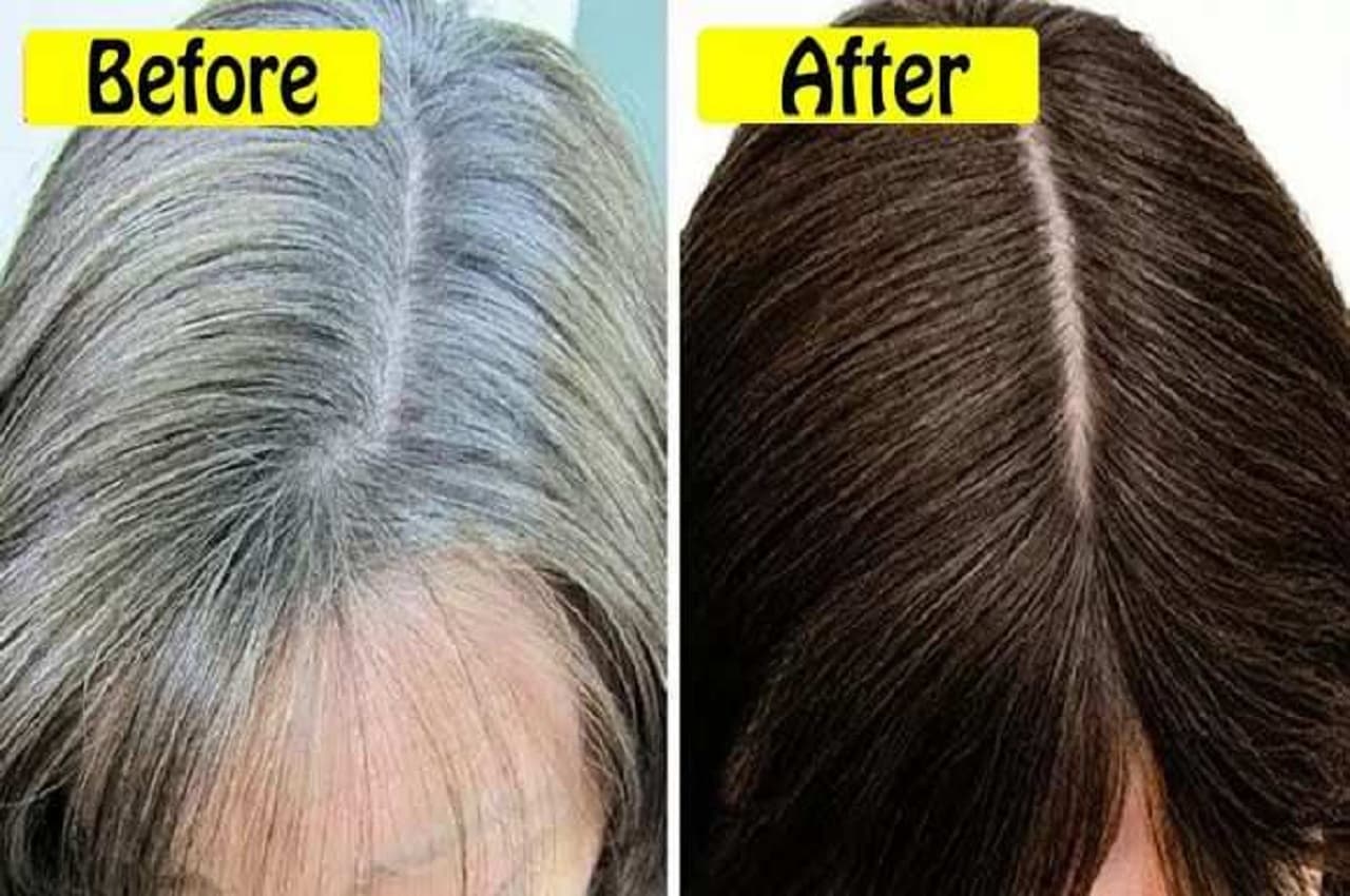 Remedy For White Hair: सफेद बालों को जड़ से काला कर देती है ये एक चीज, कुछ ही दिनों में दिखेगा असर