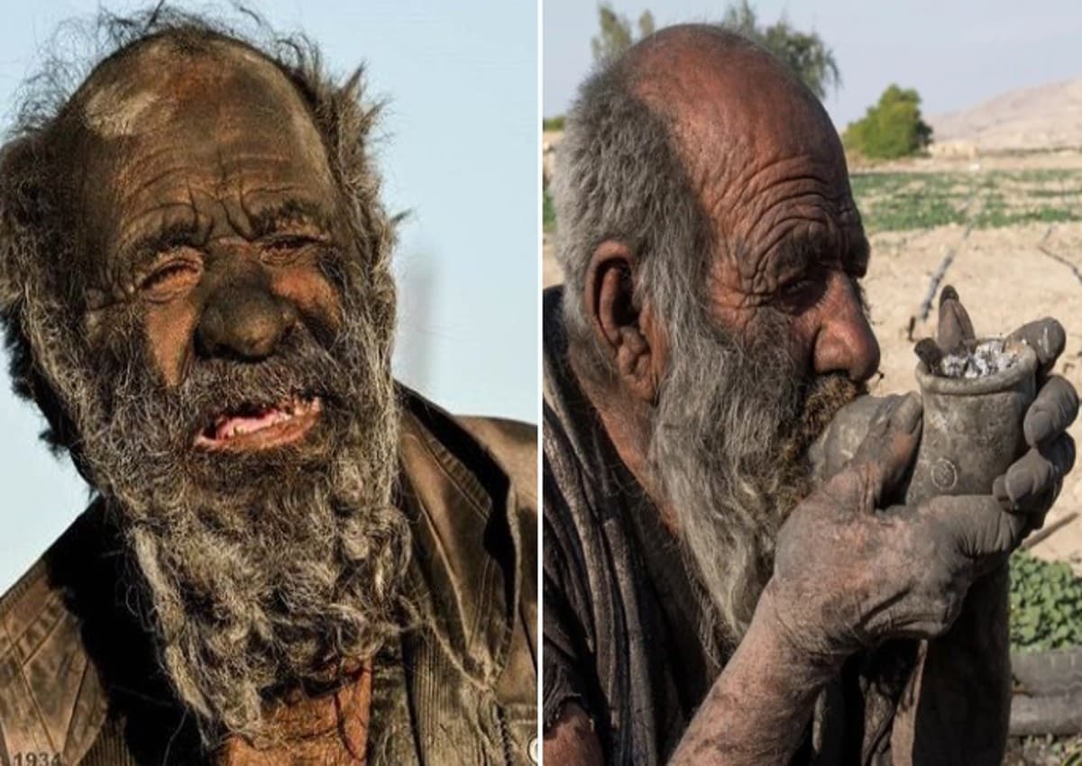 दुनिया के सबसे 'गंदे' आदमी की 94 साल की उम्र में मौत, सोशल मीडिया पर वायरल हुई थी ये तस्वीरें