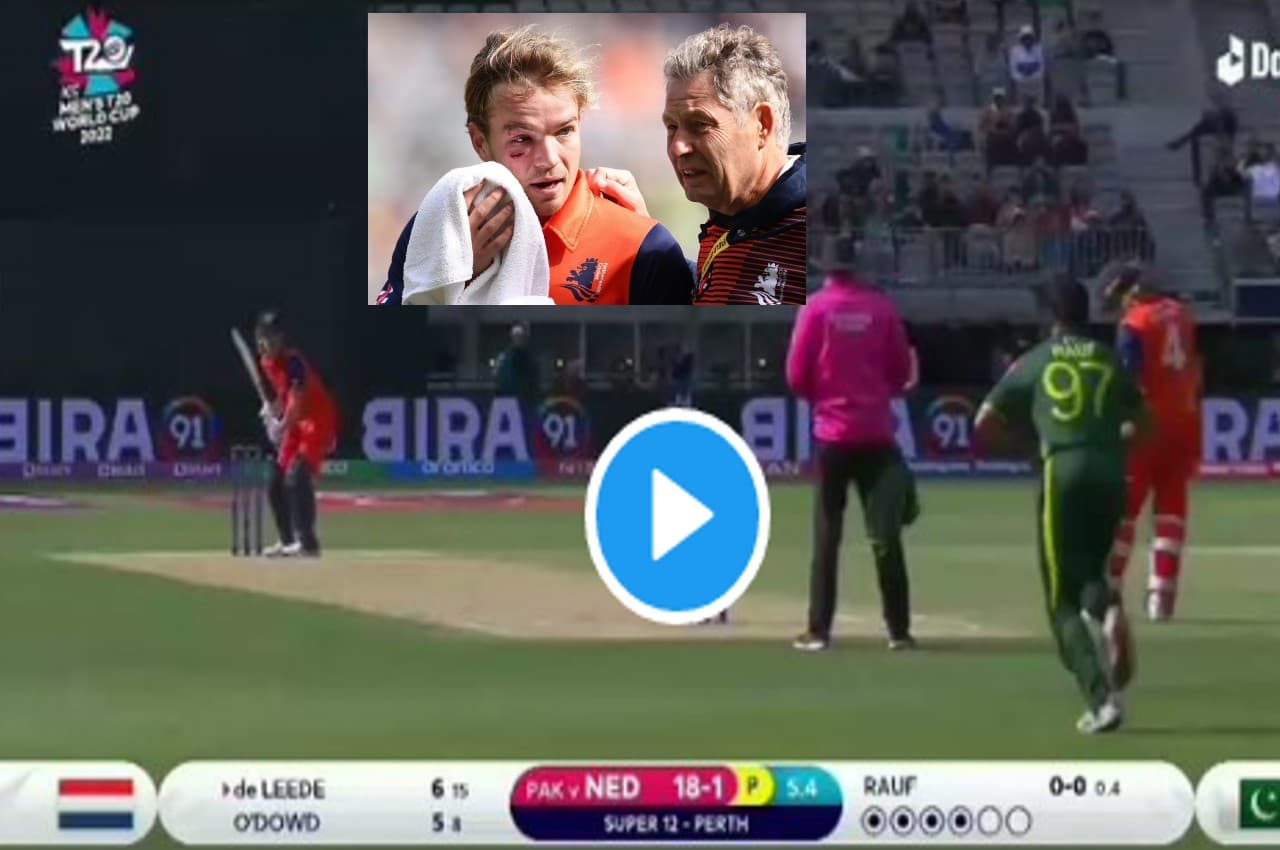 PAK vs NED: हारिस रऊफ की 'आग' उगलती गेंद ने तोड़ डाला बल्लेबाज का मुंह...निकलने लगा खून, देखें VIDEO