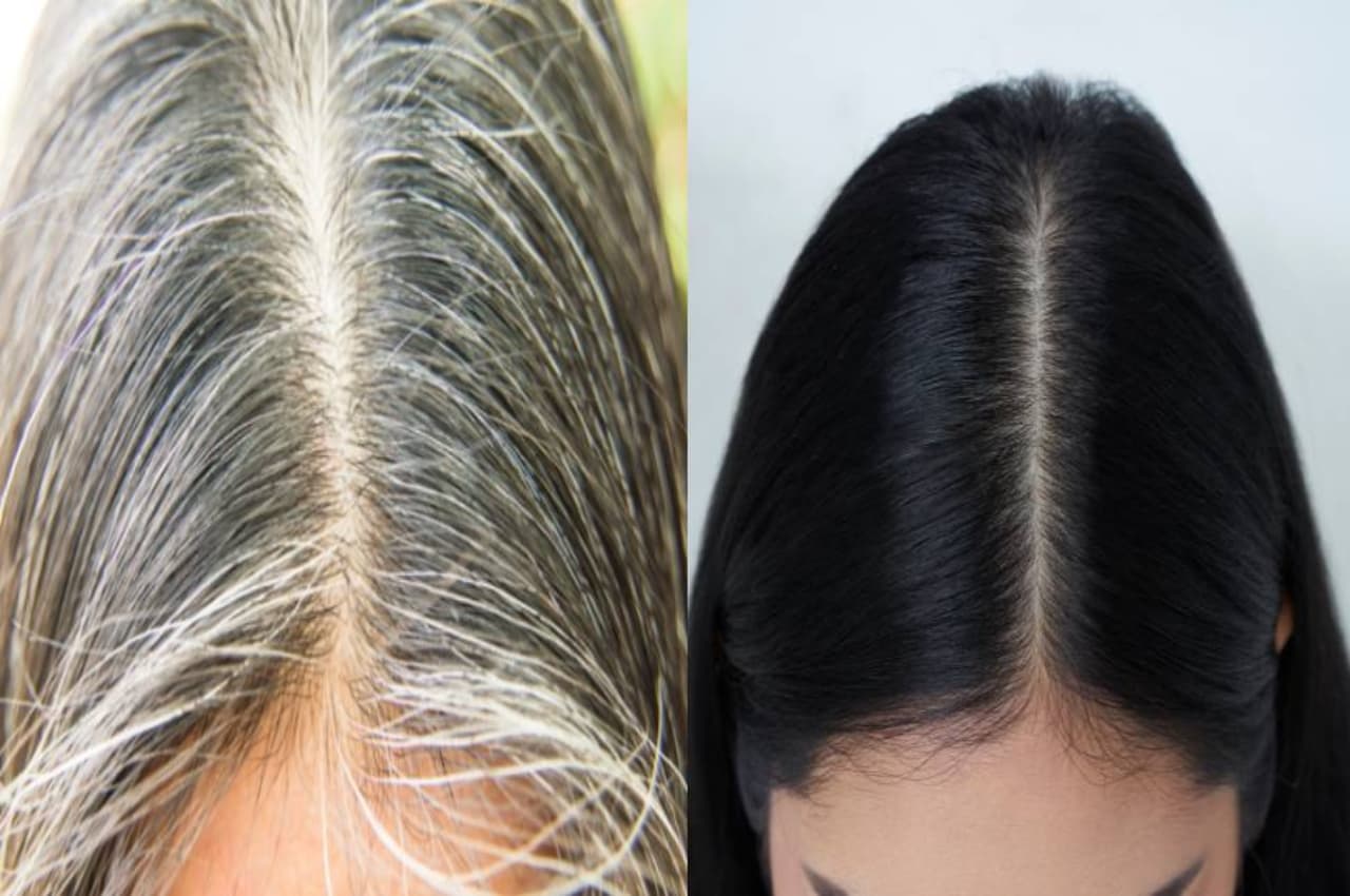 White Hair Home Remedies