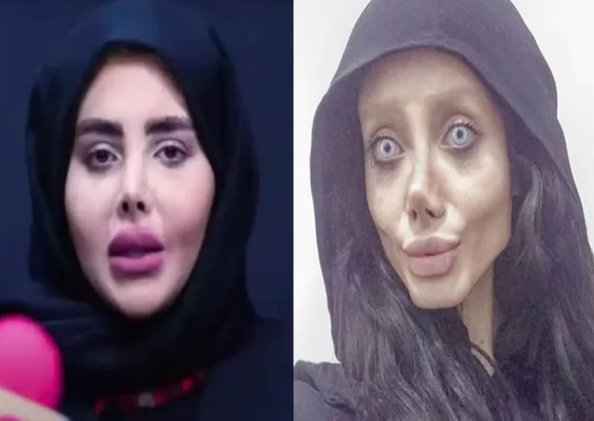 Zombie Angelina Jolie: जेल से रिहा हुई ईरान की 'जोंबी एंजेलीना जोली', असली चेहरा देखकर सिहर जाएंगे आप