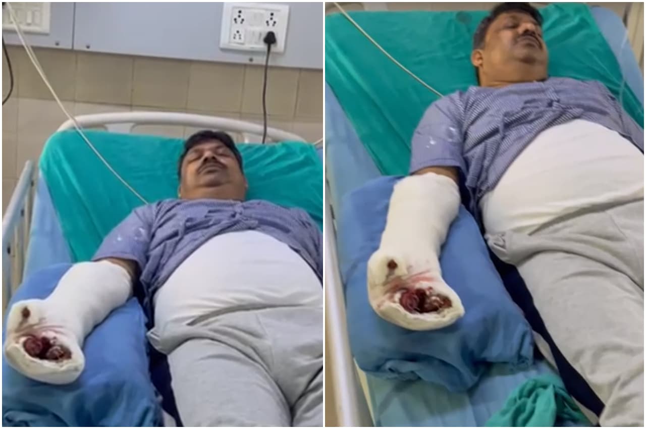 बिजनौर में आवारा कुत्ते ने पहले कराया भीषण हादसा, फिर चबा डाला पुलिस इंस्पेक्टर का हाथ, देखें