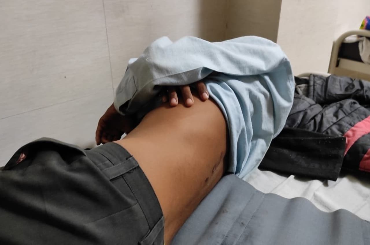 टोंक में सरकारी स्कूल का टीचर बना हैवान, स्टूडेंट की पीट-पीटकर रीढ़ की हड्डी तोड़ी