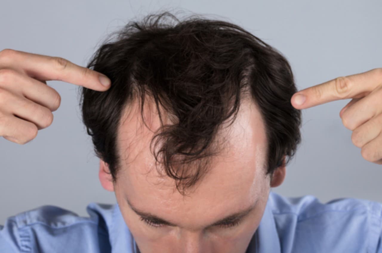 Hair Fall Stop: टूटते बालों को जड़ से मजबूत बनाए देंगी ये चीजें, सफेद होने की समस्या से भी मिलेगा निजात