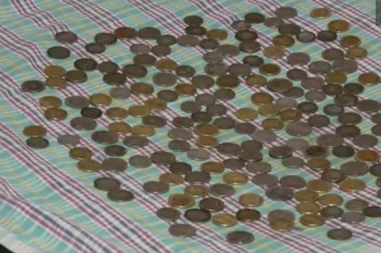 Coins In Man Stomach: डॉक्टरों ने शख्स के पेट से निकाले 1.2 KG के 187 सिक्के, जानें पूरा मामला