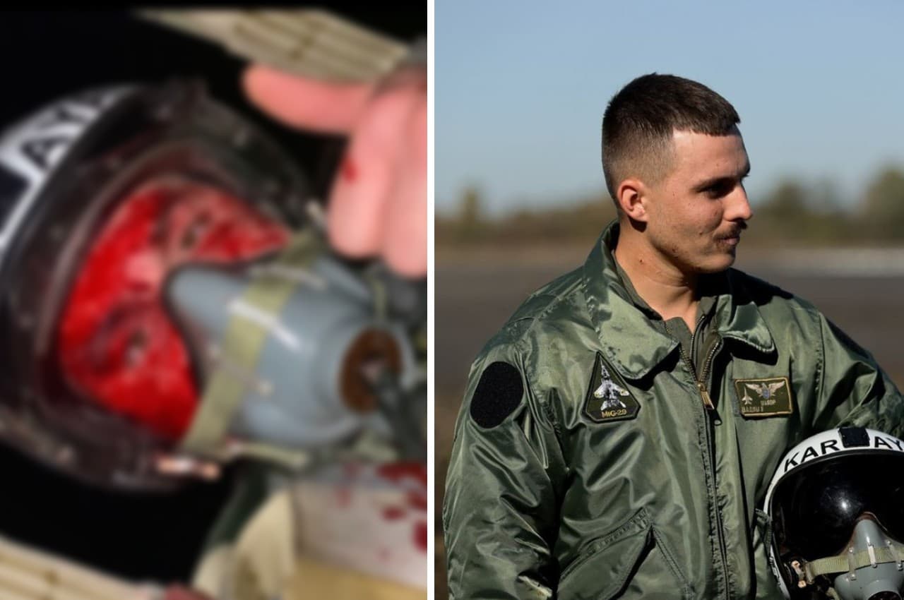 Russia Ukraine War: खून से लथपथ लड़ाकू विमान के पायलट ने ली सेल्फी, जेलेंस्की ने दिया 'Hero of Ukraine' का सम्मान