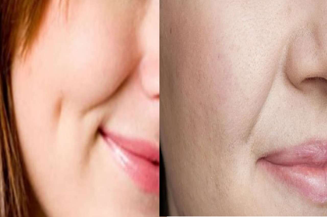 Skin Care: सर्दियों के मौसम में आजमाएं ये नुस्खे, स्किन की समस्याएं होंगी खत्म