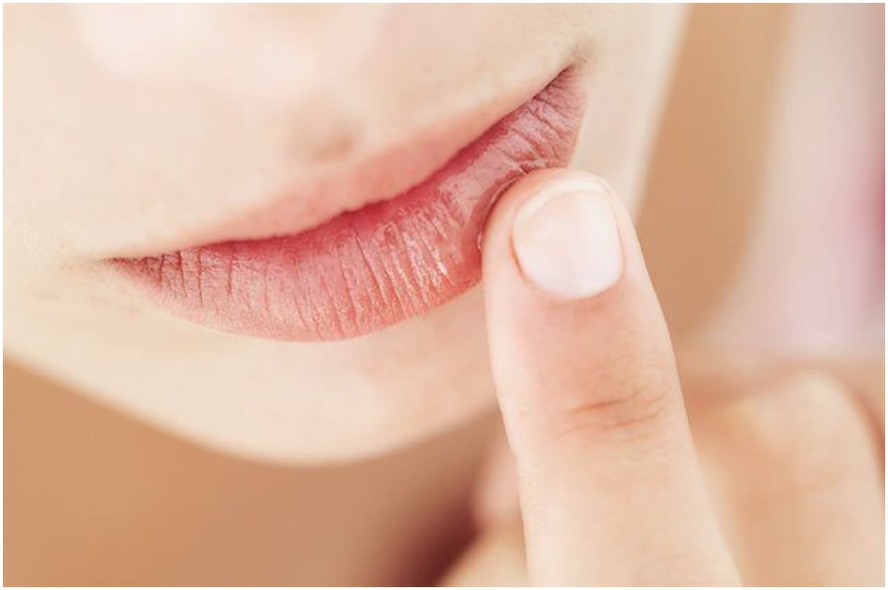 Chapped Lips in Winters: इन बुरी आदतों की वजह से फटते हैं होंठ, आज ही छोड़ दें नहीं तो...