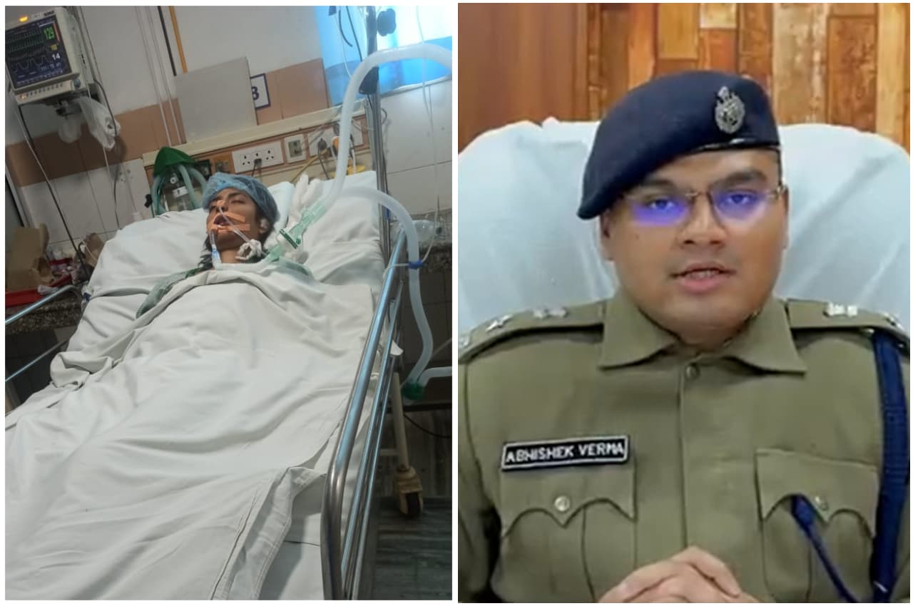 ग्रेटर नोएडा में B.Tech छात्रा स्वीटी के इलाज में एक दिन की सैलरी देगी नोएडा पुलिस, 31 की रात कार ने कुचला था
