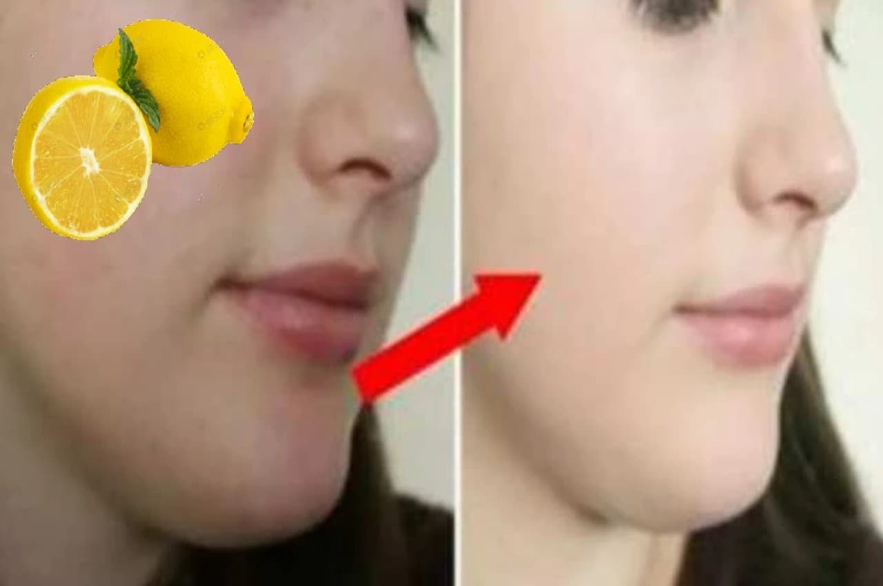 Skin Care TIPS: चेहरे के ब्लैकहेड्स और दाग-धब्बे हटा देगा नींबू, मिलेगा जबरदस्त निखार, ऐसे करें यूज