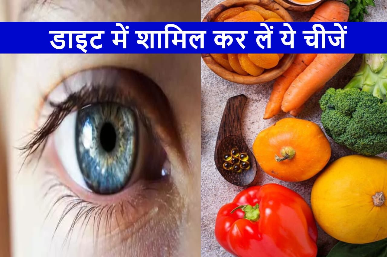 इस Vitamin की कमी से हो सकती है अंधेपन की समस्या, इम्युनिटी होती है कमजोर, तुरंत खाना शुरू करें ये फूड