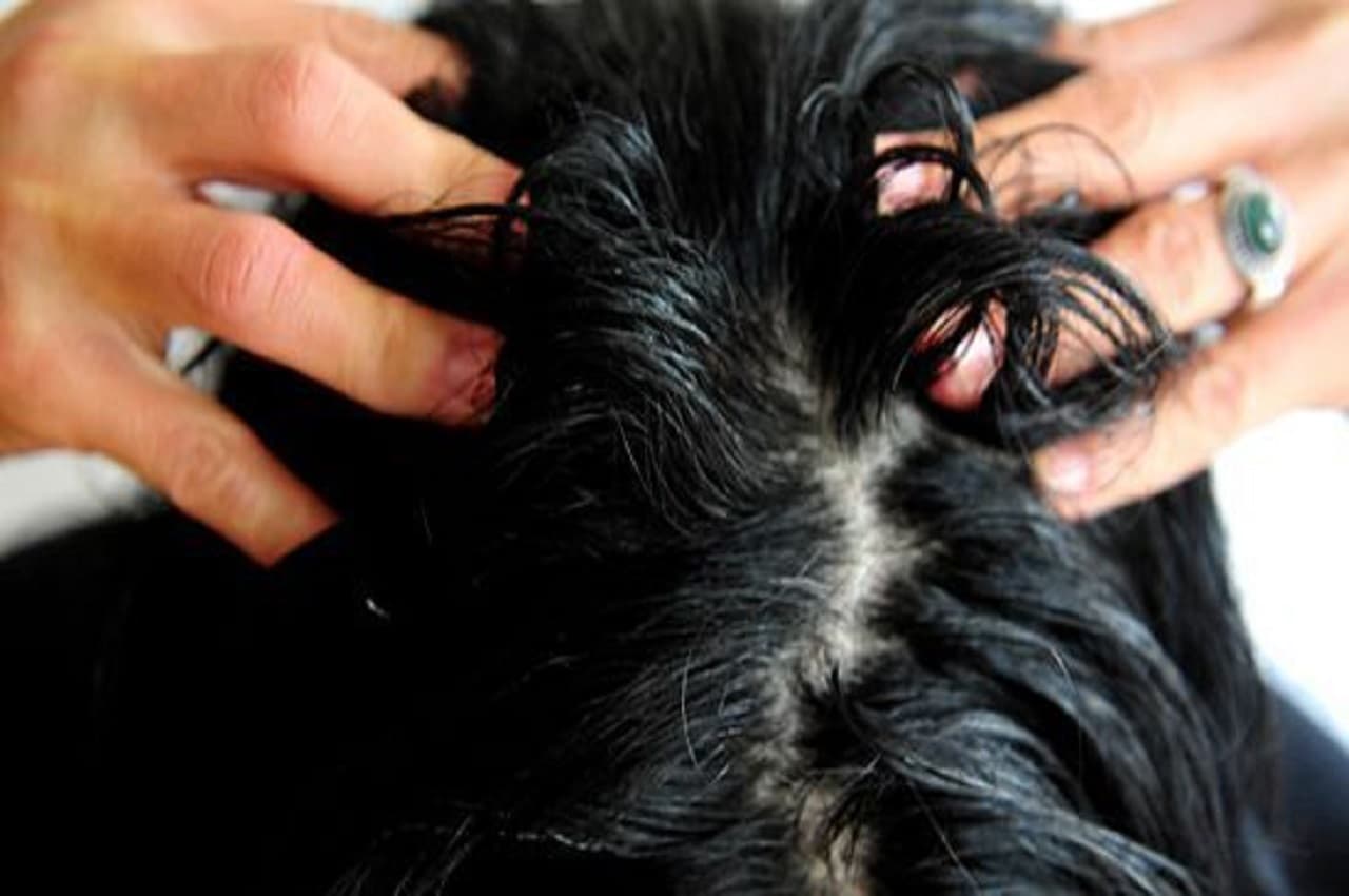 Hair Strong Oil: सर्दी में बाल टूटते हैं? घर पर ही बनाएं ऐसा तेल और फिर सिर पर लगाने से बड़े होंगे बाल और मिलेंगे कई फायदे