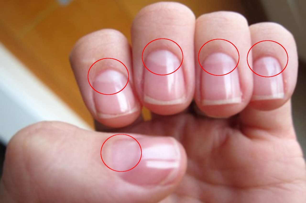 Palmistry Tips: अगर आपके हाथ के नाखूनों पर भी है सफेद अर्द्धचंद्र, तो जल्द मिलेगी यह खुशखबरी