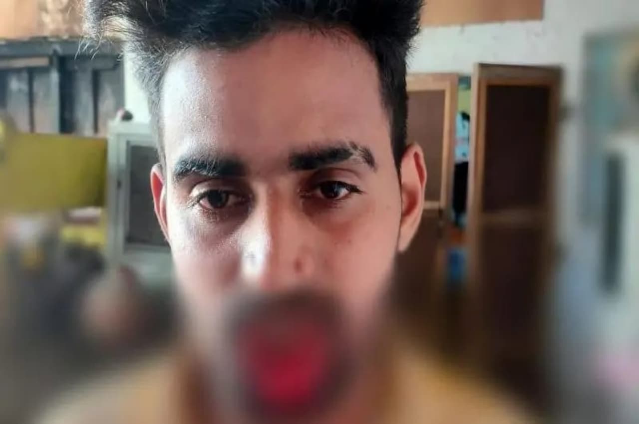 Meerut: जबरन Kiss करने पर महिला ने युवक का होंठ काटा, कटे हिस्से को अस्पताल लेकर पहुंची पुलिस, फिर...