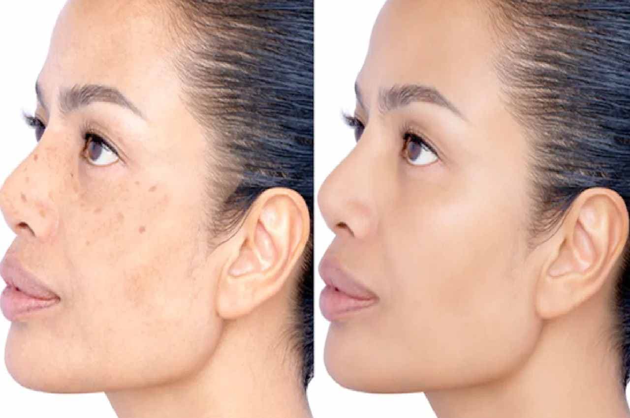 Glowing skin TIPS: ये 1 चीज बदल देगी चेहरे की रंगत....झुर्रियां-दाग होंगे गायब, मिलेगा खूबसूरत निखार