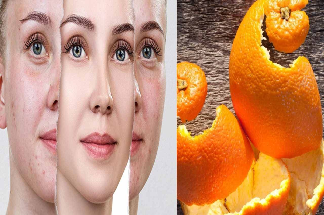 Skin care TIPS: संतरे के छिलके का ये नुस्खा देता है मनचाहा निखार, दूर होती हैं बड़ी समस्याएं