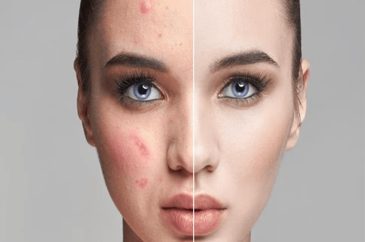 Glowing Skin in hindi: दूध में मिलाकर लगाएं ये खास चीज, गायब हो जाएंगे दाग-पिंपल, निखर जाएगी रंगत, जानें