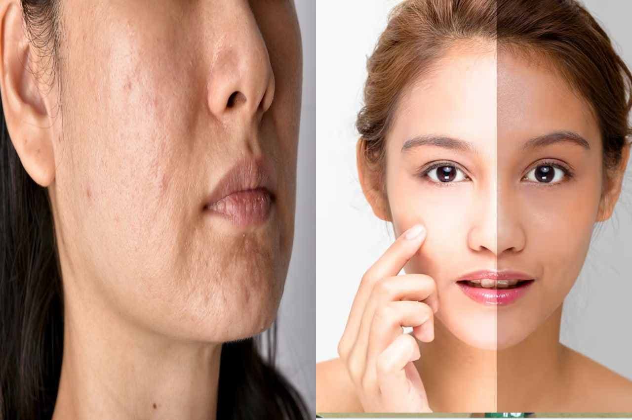 Skin Care TIPS: रात में Face पर लगाएं ये तेल...1 महीने बाद मिल जाएगा मचचाहा निखार...दाग-धब्बे, पिंपल सब होंगे छूमंतर