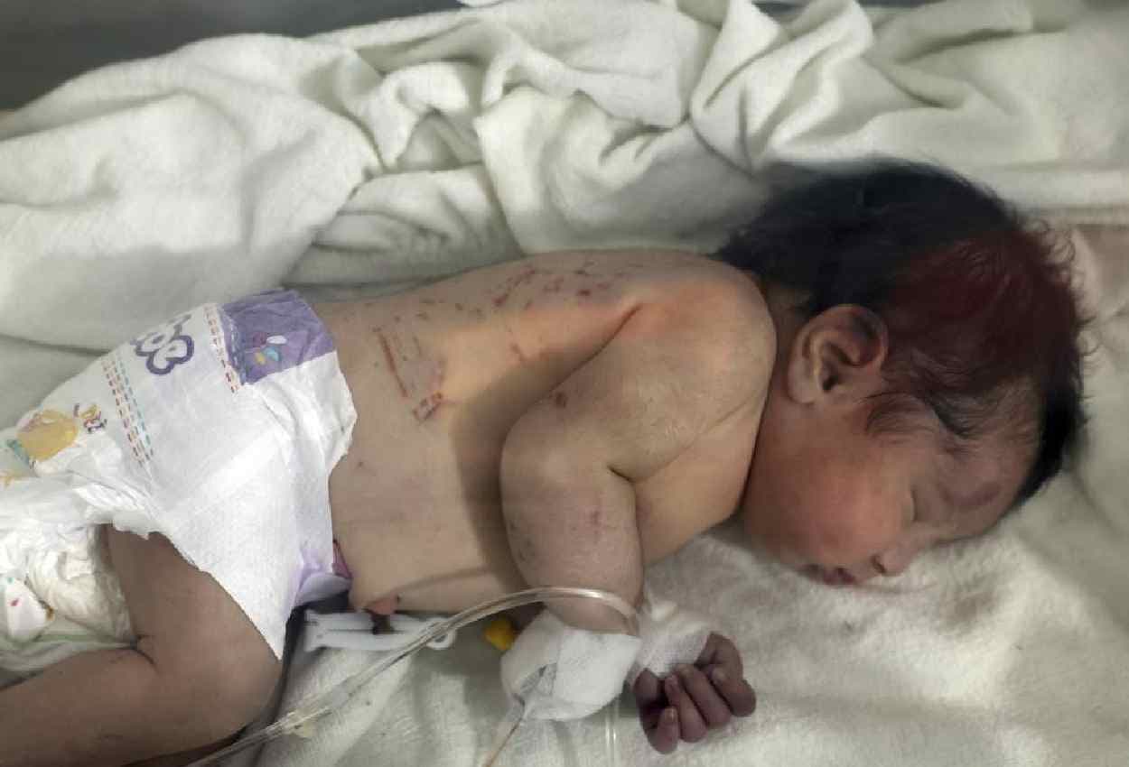 Turkey Syria Earthquake: चमत्कार... मलबे में गूंजी किलकारी, 10 घंटे बाद नवजात को सुरक्षित निकाला
