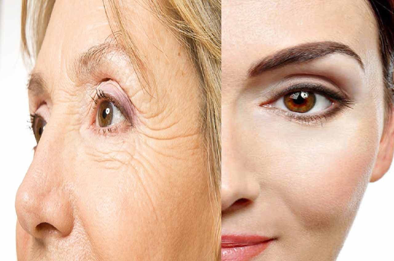 Skin care TIPS: रात में ये चीज लगाकर सो जाएं, लटकती स्किन होगी टाइट...गायब हो जाएंगी झुर्रियां