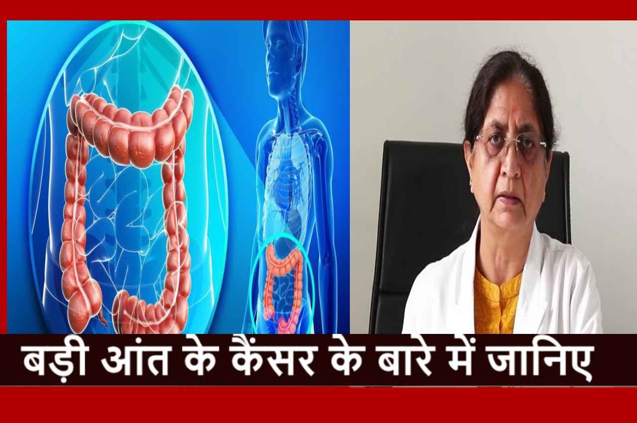 Colorectal cancer: बेहद खतरनाक है बड़ी आंत का कैंसर, Dr. Tejinder Kataria से जानिए इसके बारे में सबकुछ
