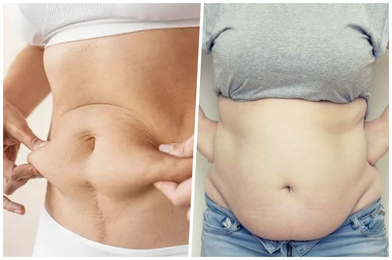Belly Fat Loss Tips: पेट के निचले हिस्से की चर्बी घटा देंगे ये 5 टिप्स