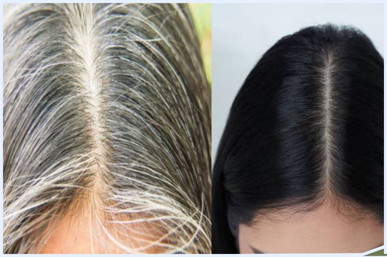 Hair care TIPS: सफेद बालों की समस्या जड़ से होगी खत्म, बस अपना लीजिए ये 3 घरेलू उपाय, जानिए