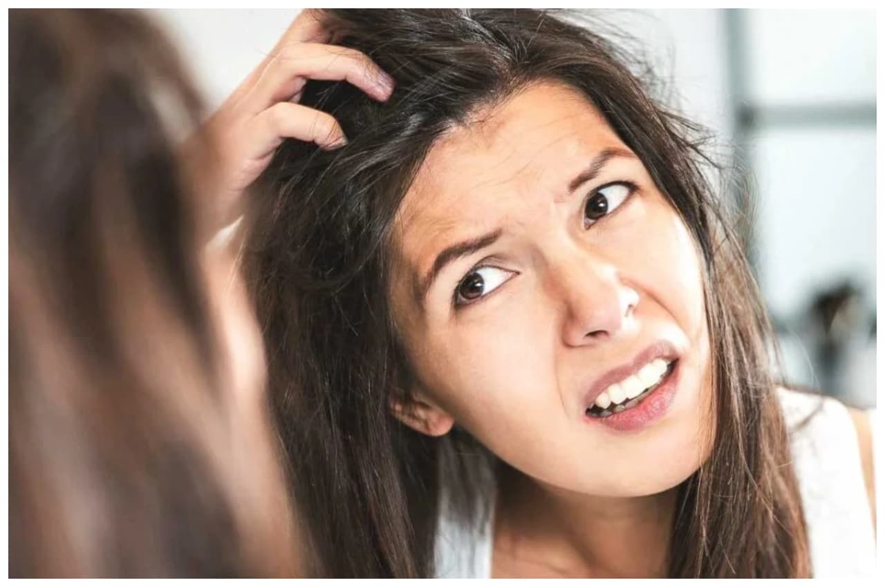 Dandruff Home Remedies: इन घरेलू उपायों से होगी डैंड्रफ की छुट्टी, आजमाकर देखें