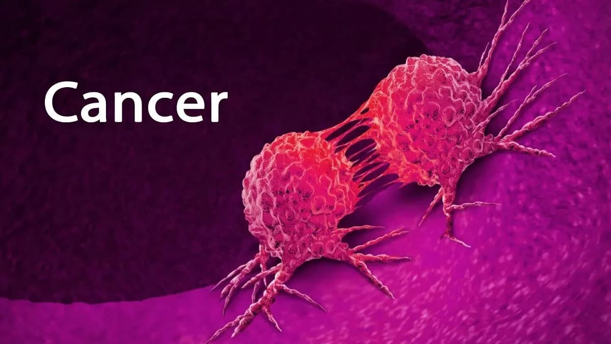 Cancer Symptoms: क्यों होता है कैंसर, क्या हैं शुरुआती लक्ष्ण? दिल्‍ली AIIMS के अध्ययन में महिलाओं पर चौंकाने वाला दावा