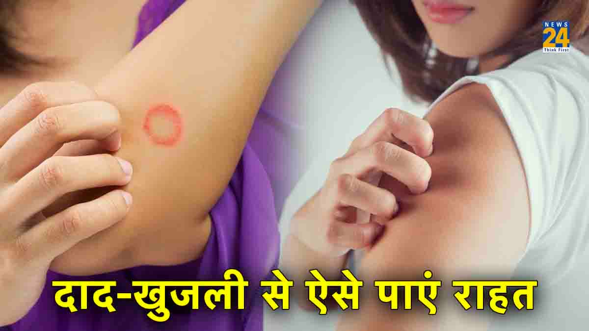 Ringworm Itching: दाद-खुजली को कर देंगे बाय-बाय, ये 5 घरेलू उपाय
