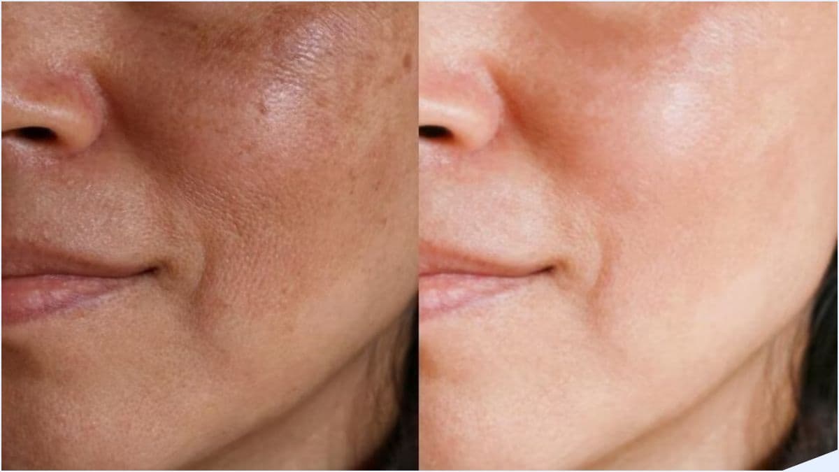 Skin Care Tips: रात में चेहरे पर लगाएं ये खास चीज, कुछ ही दिनों में चमक जाएगा फेस!