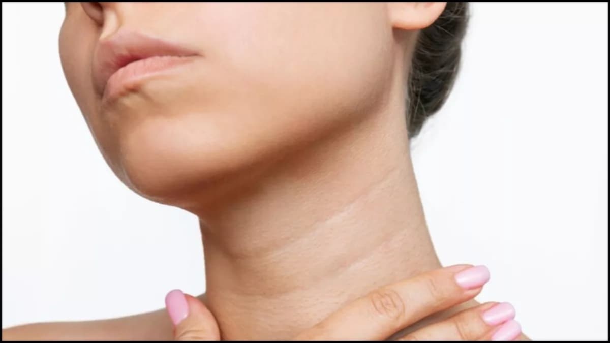Beauty Tips: गर्दन के कालेपन को दूर करने के लिए आजमाएं ये घरेलू उपाय, दिखेगा चमत्कारी रिजल्ट