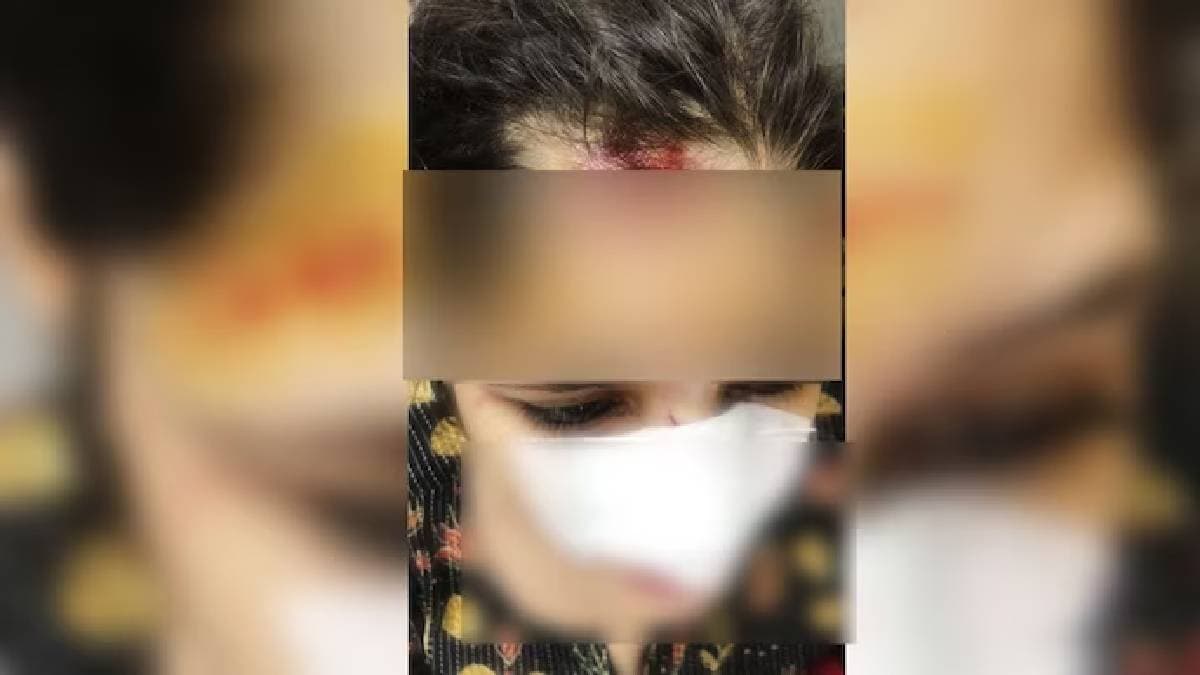 iPhone बचाने के चक्कर में ऑटो से गिरी महिला, बाइक सवारों ने सड़क पर घसीटा