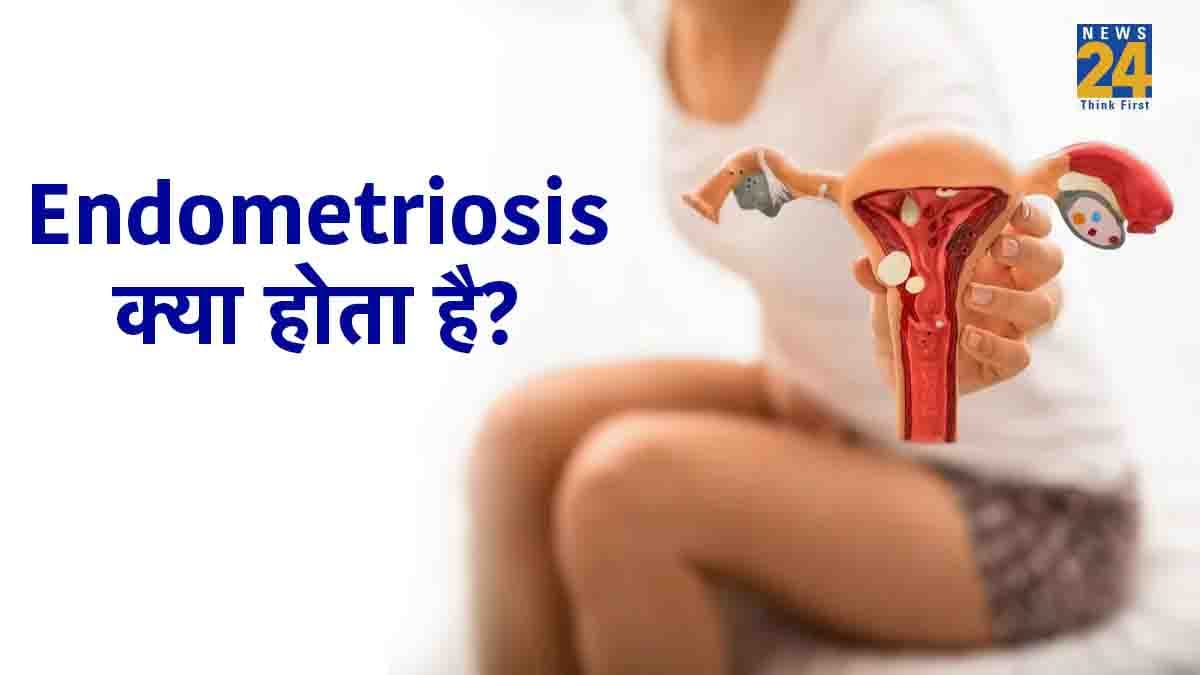 Endometriosis से क्यों महिलाएं होती हैं ज्यादा प्रभावित, जानें कारण, लक्षण और बचाव