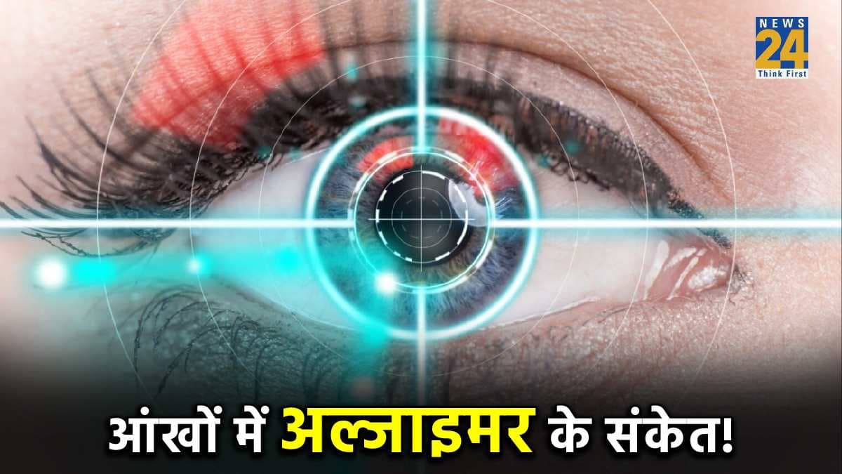 आंखों से पता चलेगी 'भूल जाने' की बीमारी, अल्जाइमर को लेकर आया नया शोध