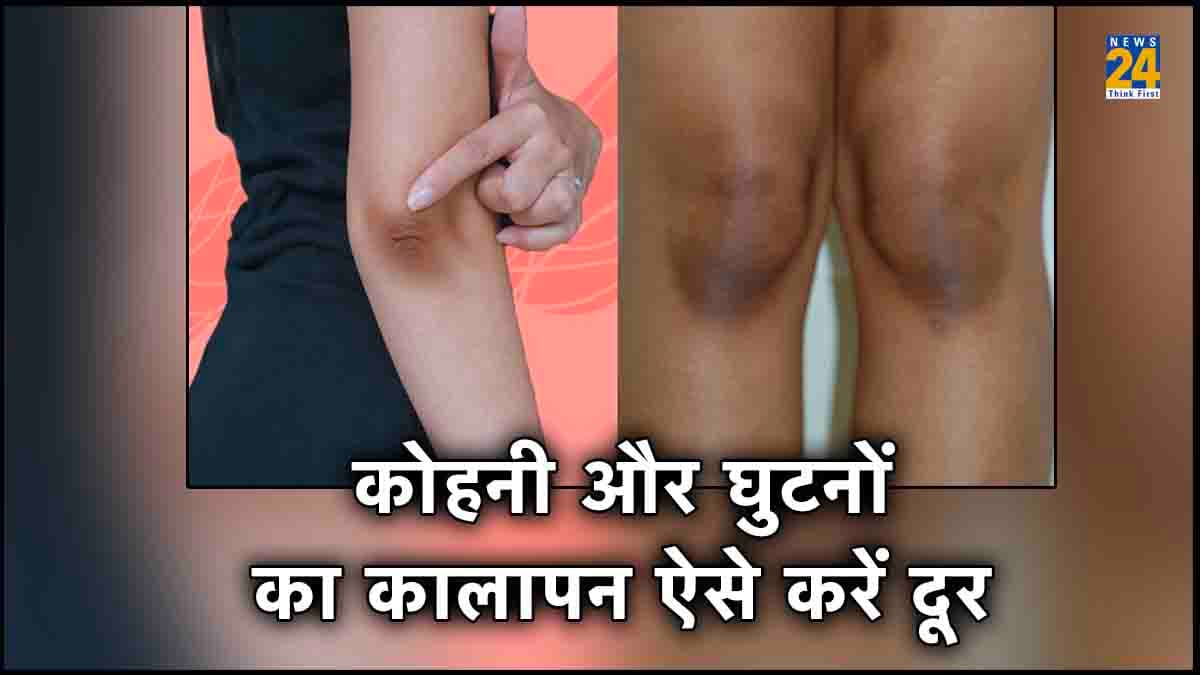 कोहनी और घुटनों के कालेपन की समस्या से हैं परेशान, तो अपनाएं ये घरेलू उपाय