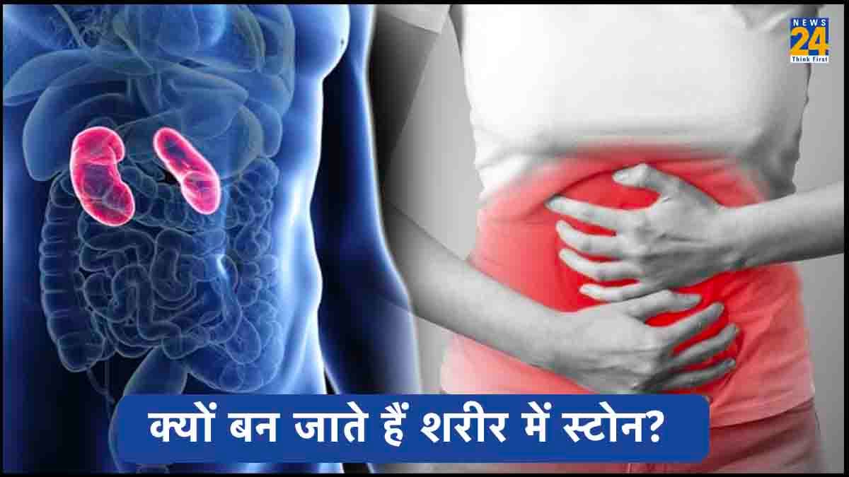 रोजमर्रा की इन चीजों से भी होती है पथरी, क्या आपको भी दिखें ये लक्षण