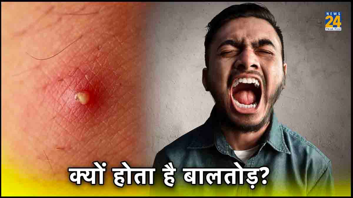 किस वजह से होता है बालतोड़, जानें इसके लक्षण, कारण और बचाव