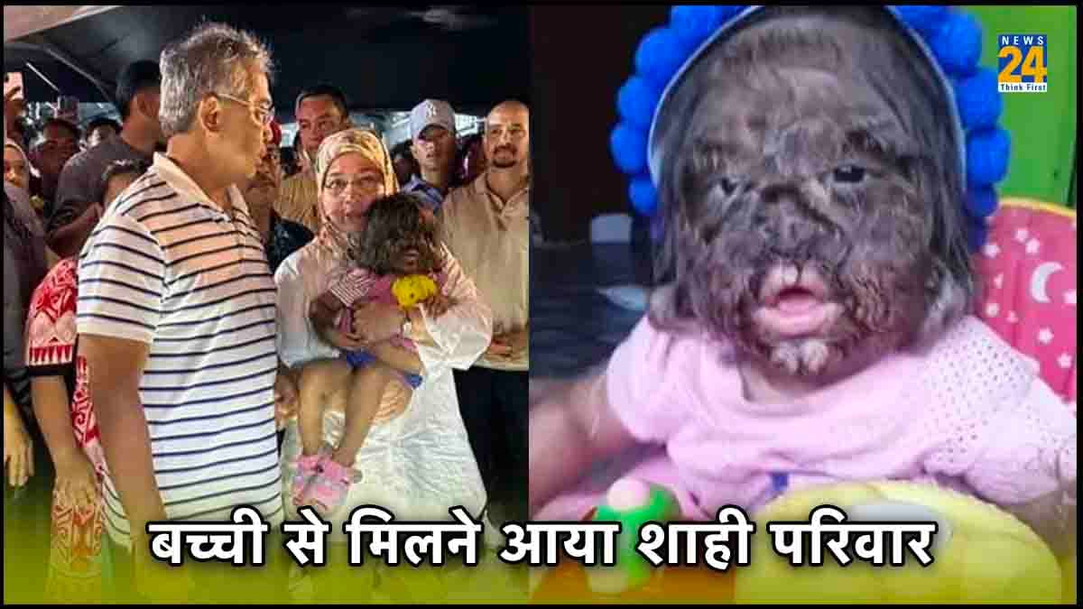 दो साल की बच्ची के चेहरे पर उगी दाढ़ी-मूंछ, शाही फैमिली ने कहा- स्वर्ग से आई परी, जानिए क्या है राज?