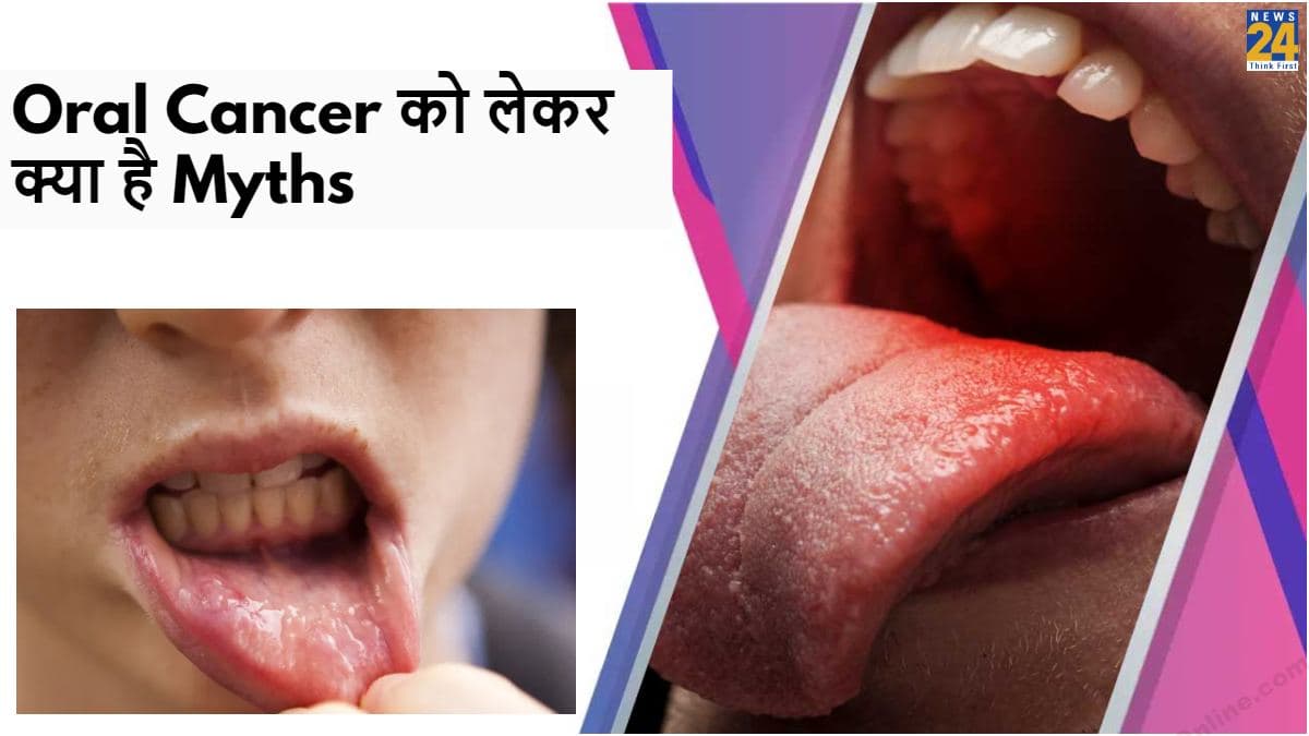 मुंह के छालों से हैं परेशान, तो ये खबर और भी कर सकती है हैरान; जानें ये 4 गलतफहमिया