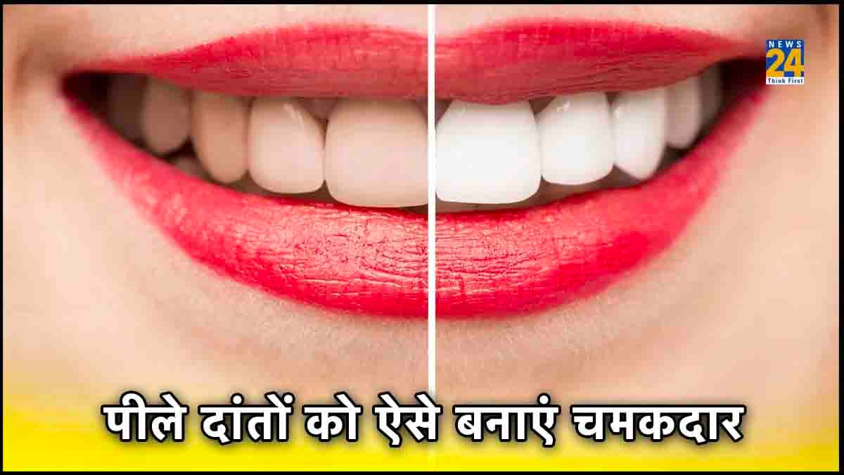 सिर्फ 10 रुपये में पीले दांतों को चमकदार बनाएं! अपनाएं ये घरेलू नुस्खे