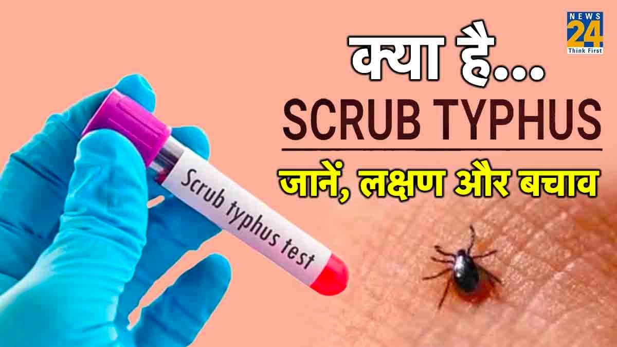 निपाह के बाद अब स्क्रब टाइफस का खौफ! इन इलाकों में बरपा रहा कहर; अब तक 15 लोगों की मौत