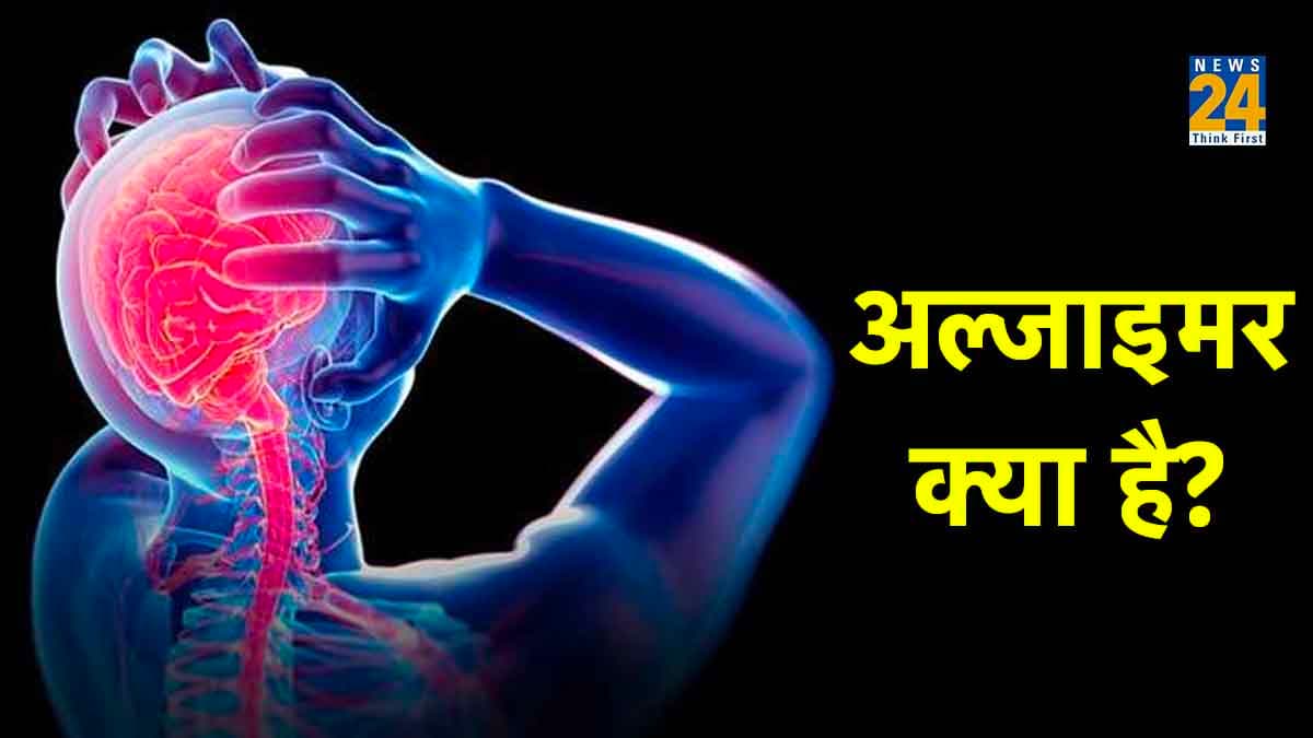 Medical जगत में क्रांति, लाइलाज बीमारी Alzheimer का संभव हुआ इलाज, पहली दवा को मंजूरी