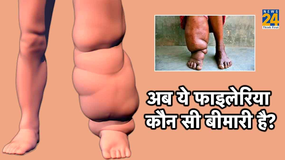 मच्छर के काटने से सिर्फ डेंगू ही नहीं हो सकती है ये जानलेवा बीमारी, हाथ-पैरों पर आ जाती है सूजन